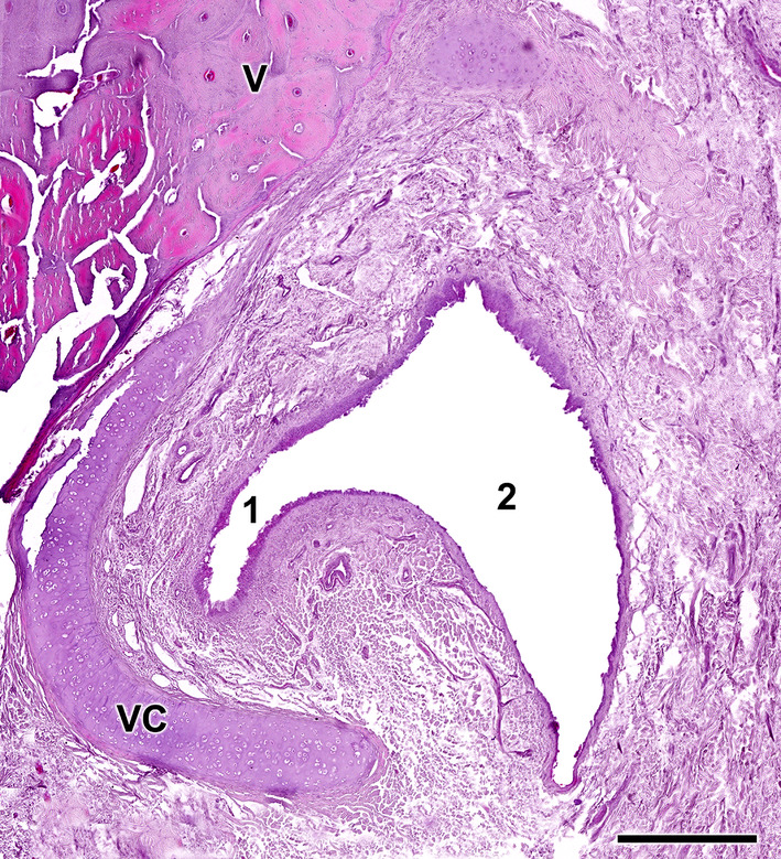 FIGURE 14