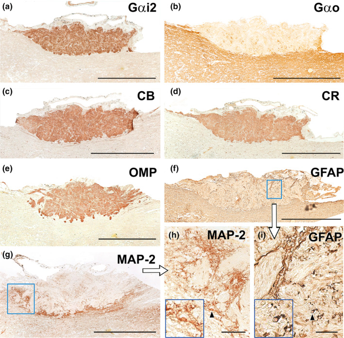 FIGURE 20