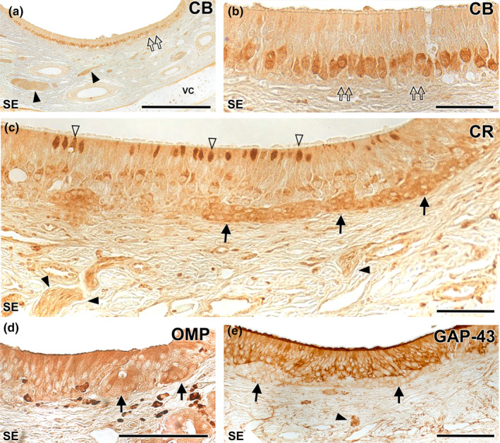 FIGURE 17