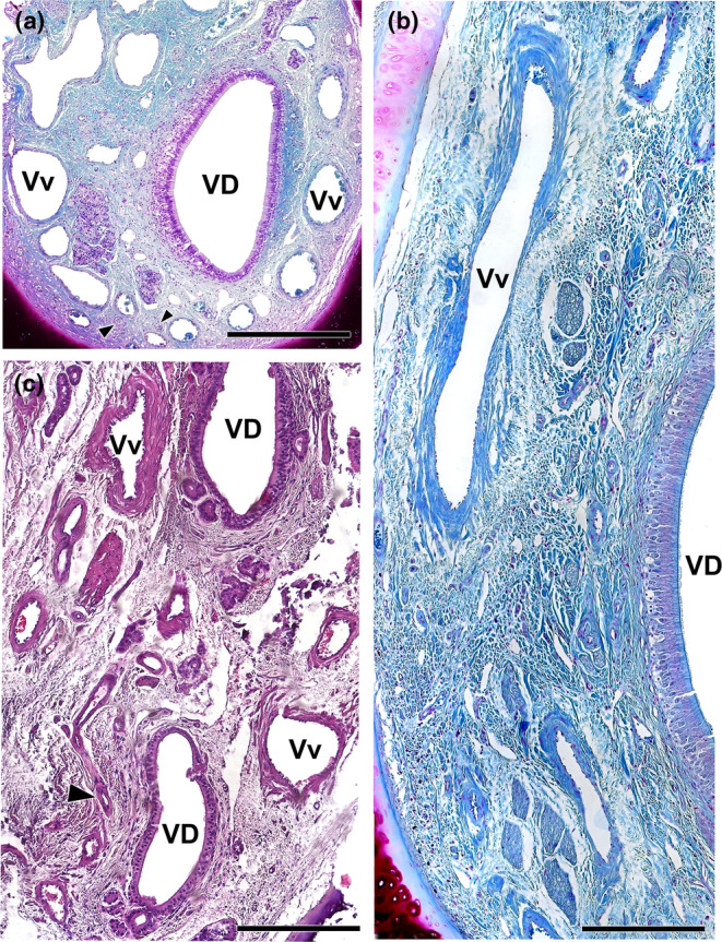 FIGURE 11