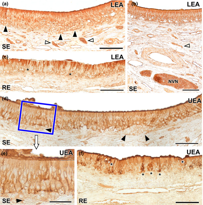 FIGURE 15