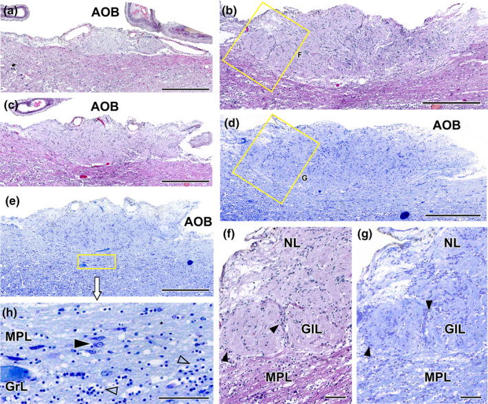 FIGURE 19