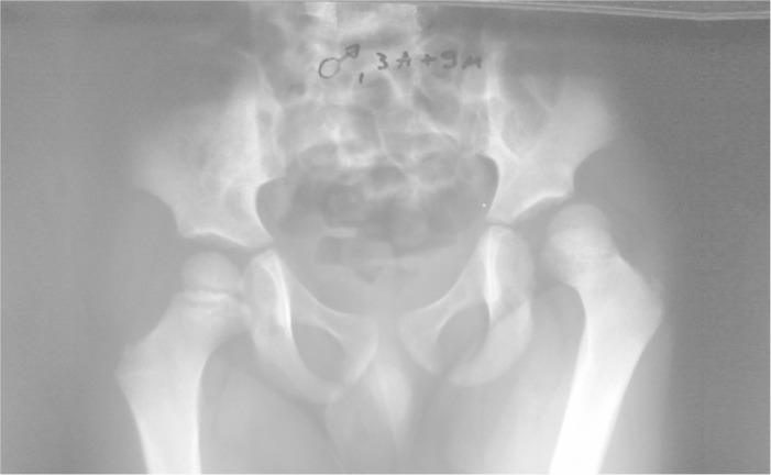 Figure 2A