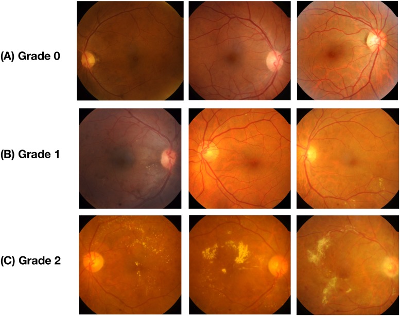 Fig 1