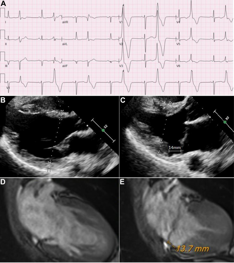 Figure 1