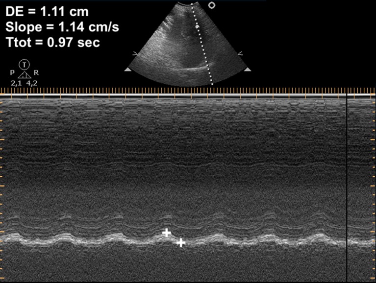 Fig. 4