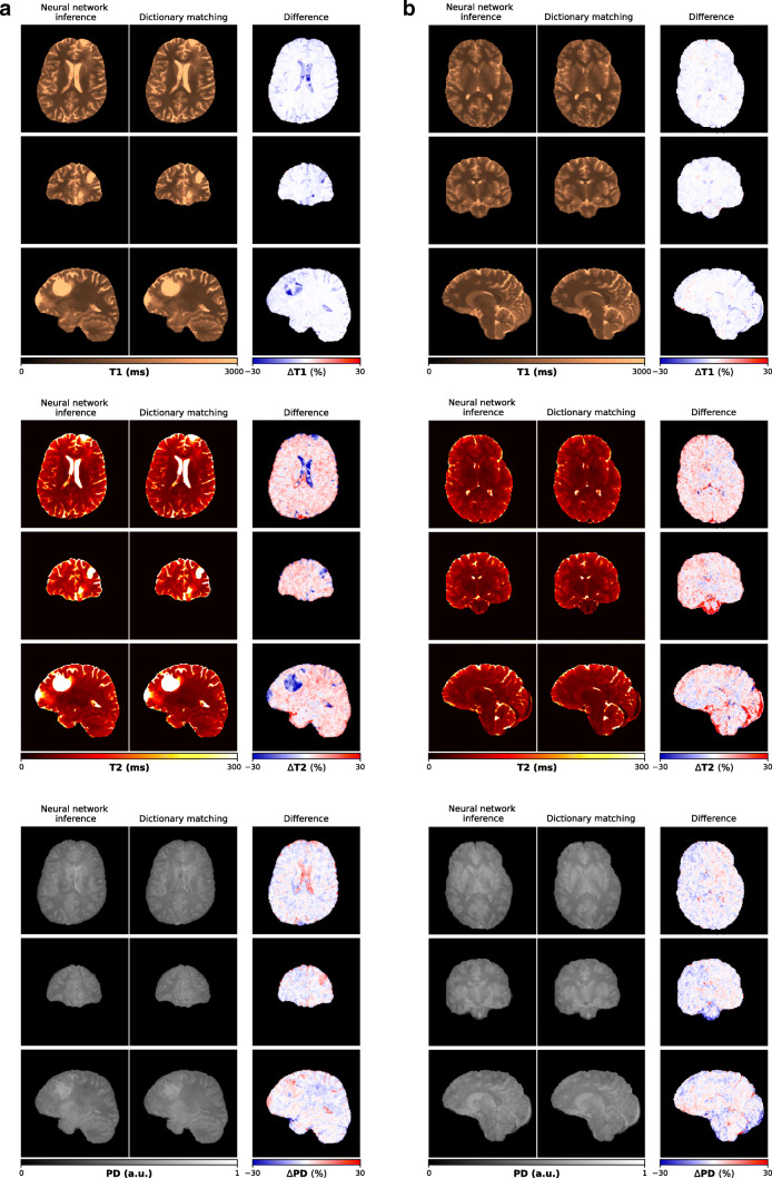 Fig. 10