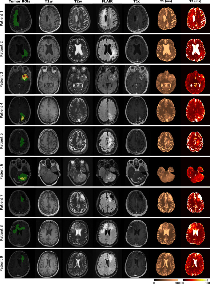 Fig. 6