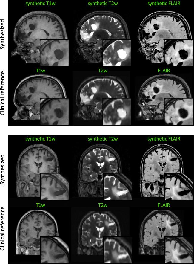 Fig. 11