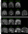 Fig. 12