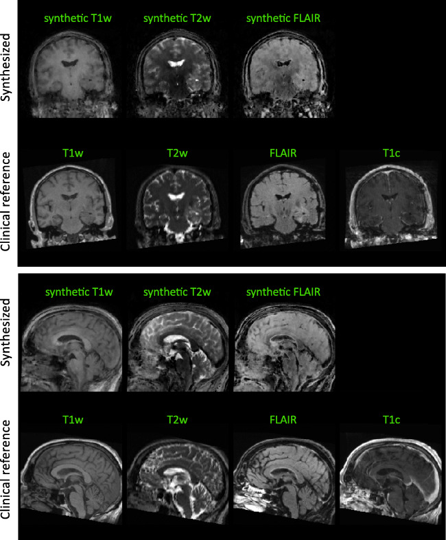 Fig. 12