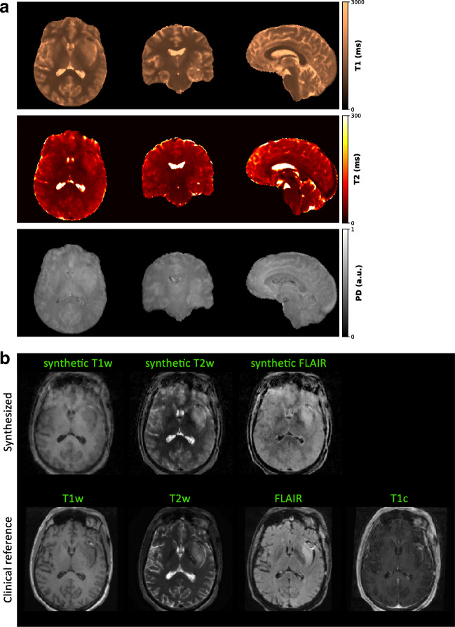 Fig. 4