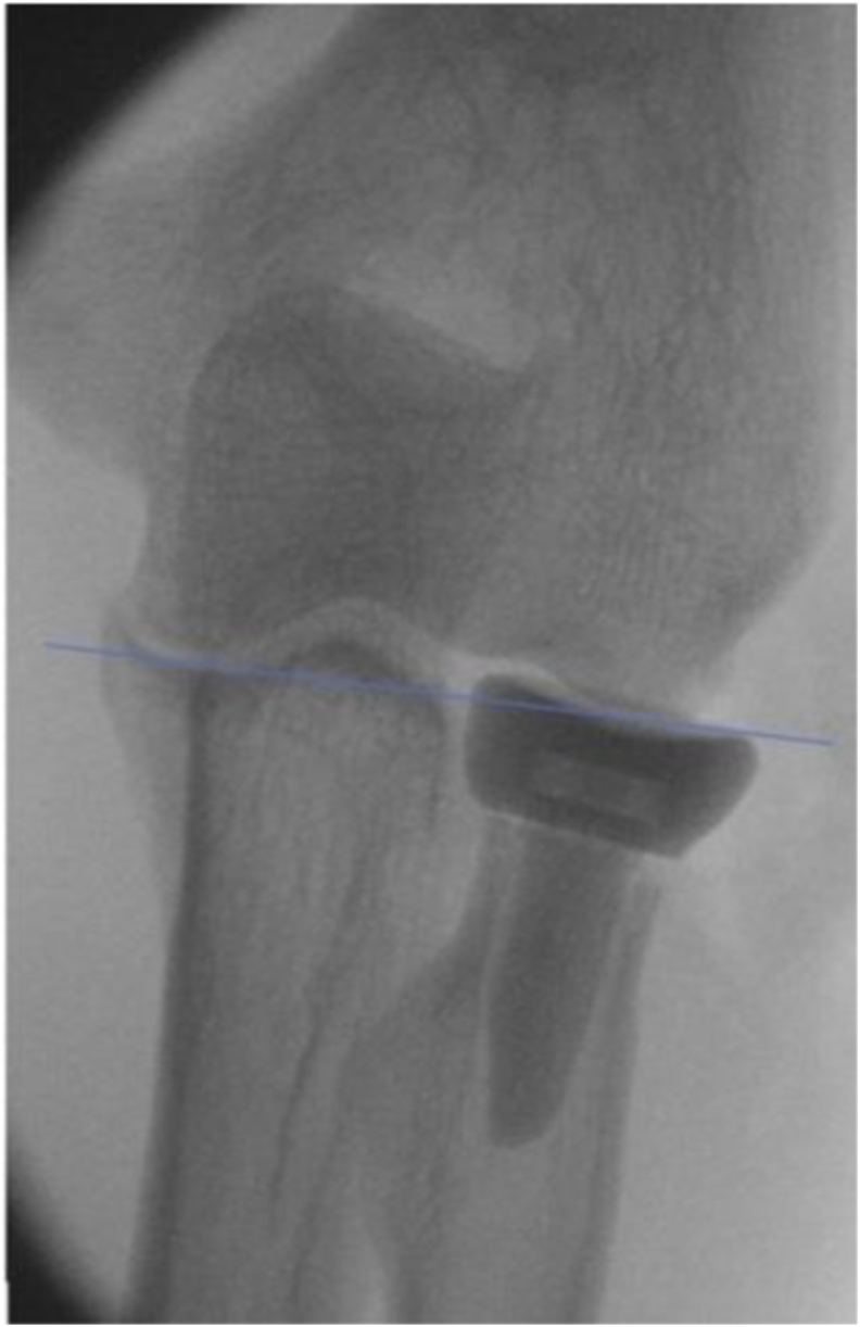 Fig. 2