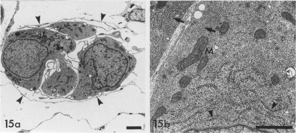 Fig. 15