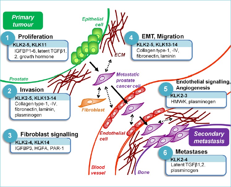 KLKs implicated in 6 ‘hallmarks’ of prostate cancer progression, by their in vitro substrates, are shown. KLK-expressing prostate cancer epithelial cells exhibit deregulated proliferation and invade through the surrounding basal lamina and extracellular matrix (ECM). Cancer cells interact with stromal fibroblasts mroblasts, as well asundergoing anepithelial-to-mesenchymal transition migratory prostate cancer cells interact with endothelial cells, lining blood vessels and gain entry to the vasculature. Cancer cells must also activate blood vessel formation or angiogenesis, to supply oxygen and nutrients to the expanding primary tumour. Migrating prostate cancer cells extravasate at the compatible secondary site, bone, whereby they degrade the surrounding matrix and form osteoblastic metastases. Arrows show the physical migration of a prostate cancer cell from the primary tumour to a secondary metastatic deposit. Dotted arrows represent KLK-mediated interactions between prostate cancer cells and cells or ECM in the surrounding microenvironment. Only those substrates referenced in the text are shown. IGFBP, insulin-like growth factor binding protein; TGF, transforming growth factor; HGFA, hepatocyte growth factor activator; PAR, protease-activated receptor; HMWK, high molecular weight kininogen.