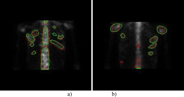 Fig 13