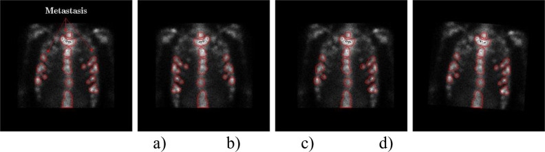 Fig 3