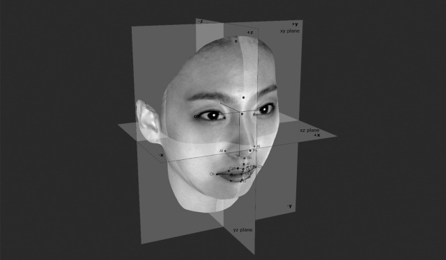 Figure 3. Soft tissue landmarks and three-dimensional coordinate system: x-axis (left-right axis; left [+], right [−]), y-axis (vertical axis; superior [+], inferior [−]), and z-axis (anteroposterior axis; anterior [+], posterior [−]).