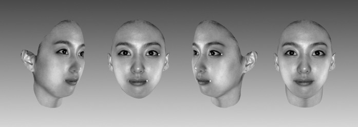 Figure 1. The process of three-dimensional photograph taking and registration.