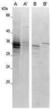 FIG. 1-1