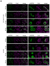 Figure 3—figure supplement 4.