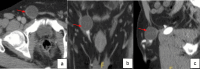 Fig. 11