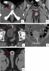 Fig. 4