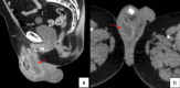 Fig. 9