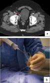 Fig. 14
