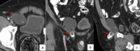 Fig. 12