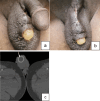 Fig. 10
