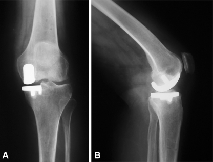 Fig. 4A–B