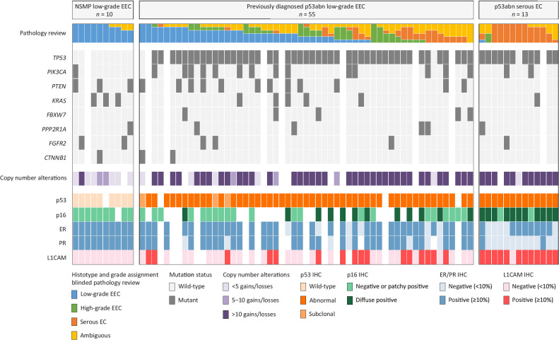 Figure 2. Molecular landscape of stage I low-grade (grade 1–2) p53abn EECs and controls. Histopathologic and molecular landscape of p53abn ECs previously diagnosed as low-grade endometrioid. Cases are stratified by consensus on a low-grade endometrioid diagnosis after blinded pathology review by six expert gynecologic pathologists. White tiles indicate missing data due to insufficient material or failed analysis. L1CAM, L1 cell adhesion molecule; NSMP, no specific molecular profile.