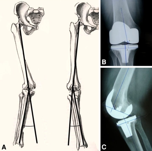 Fig. 1A–C