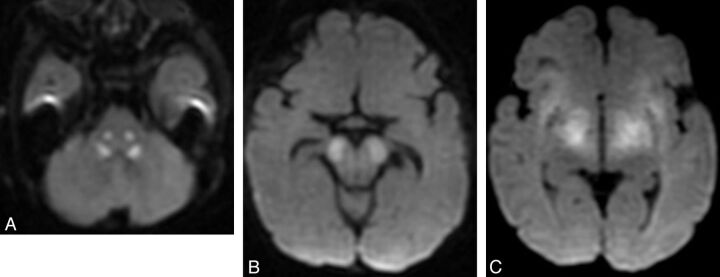 Fig 10.