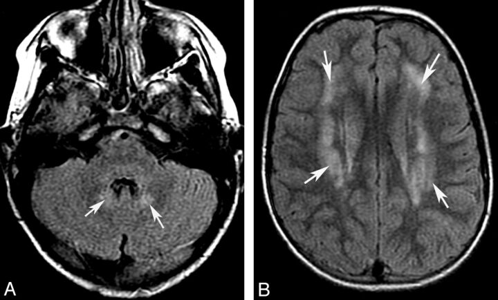 Fig 6.