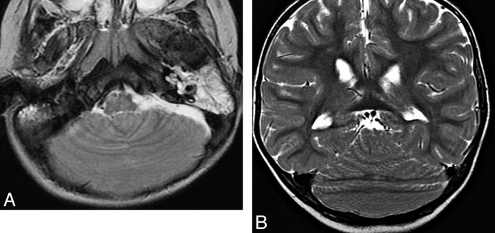 Fig 15.