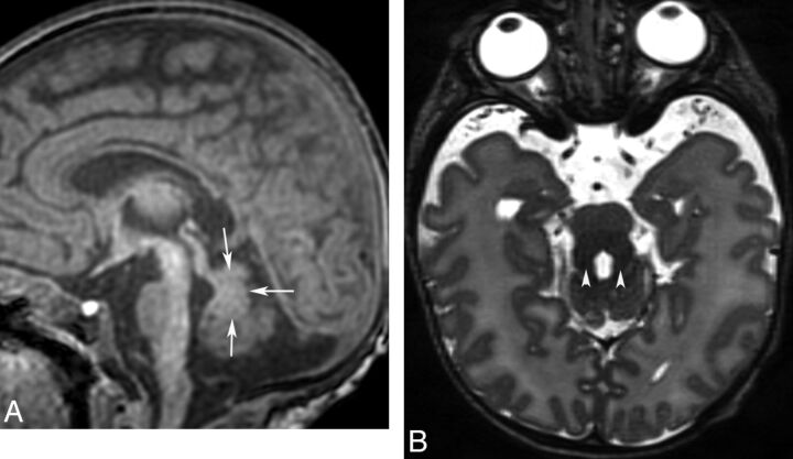 Fig 14.