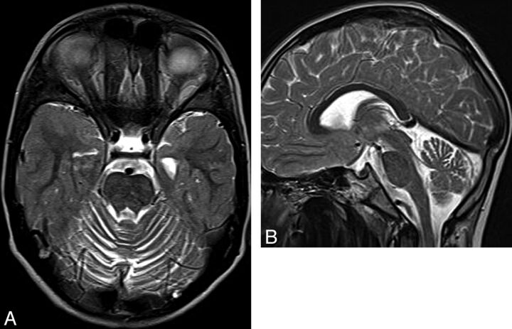 Fig 2.