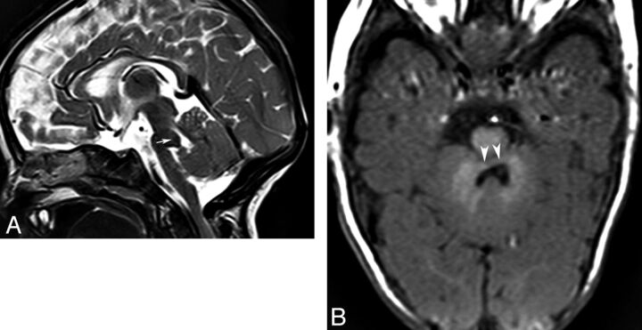 Fig 17.