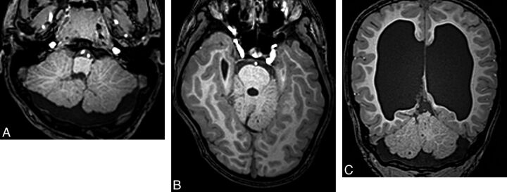 Fig 16.