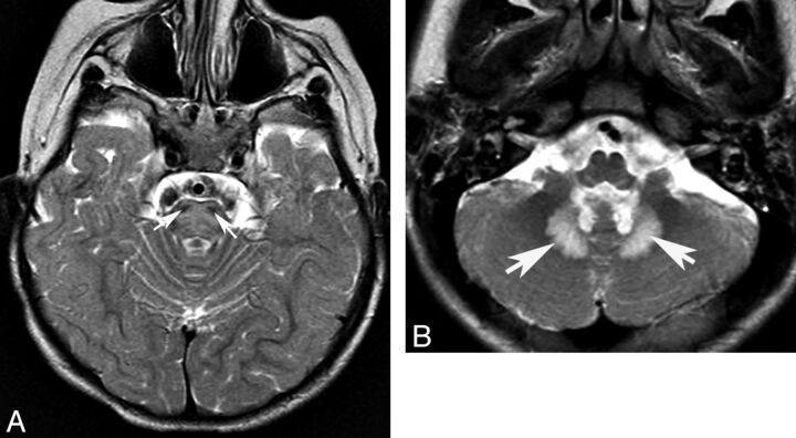 Fig 9.