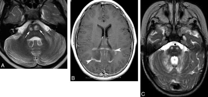 Fig 7.