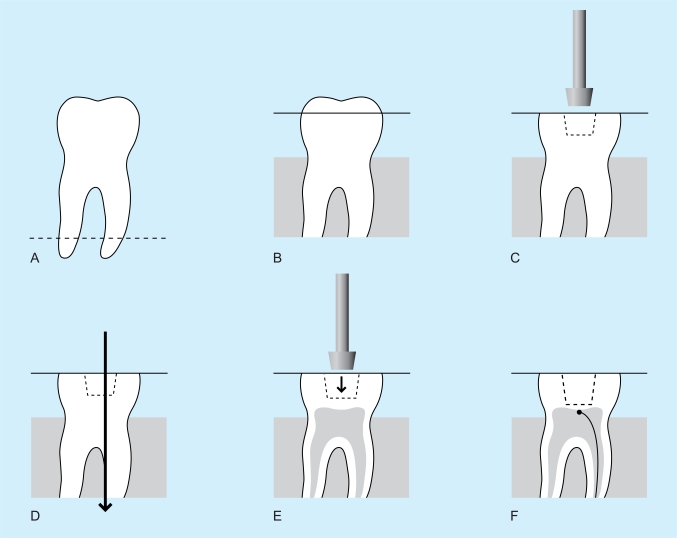 Fig. (1)