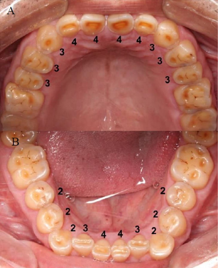 Fig 1