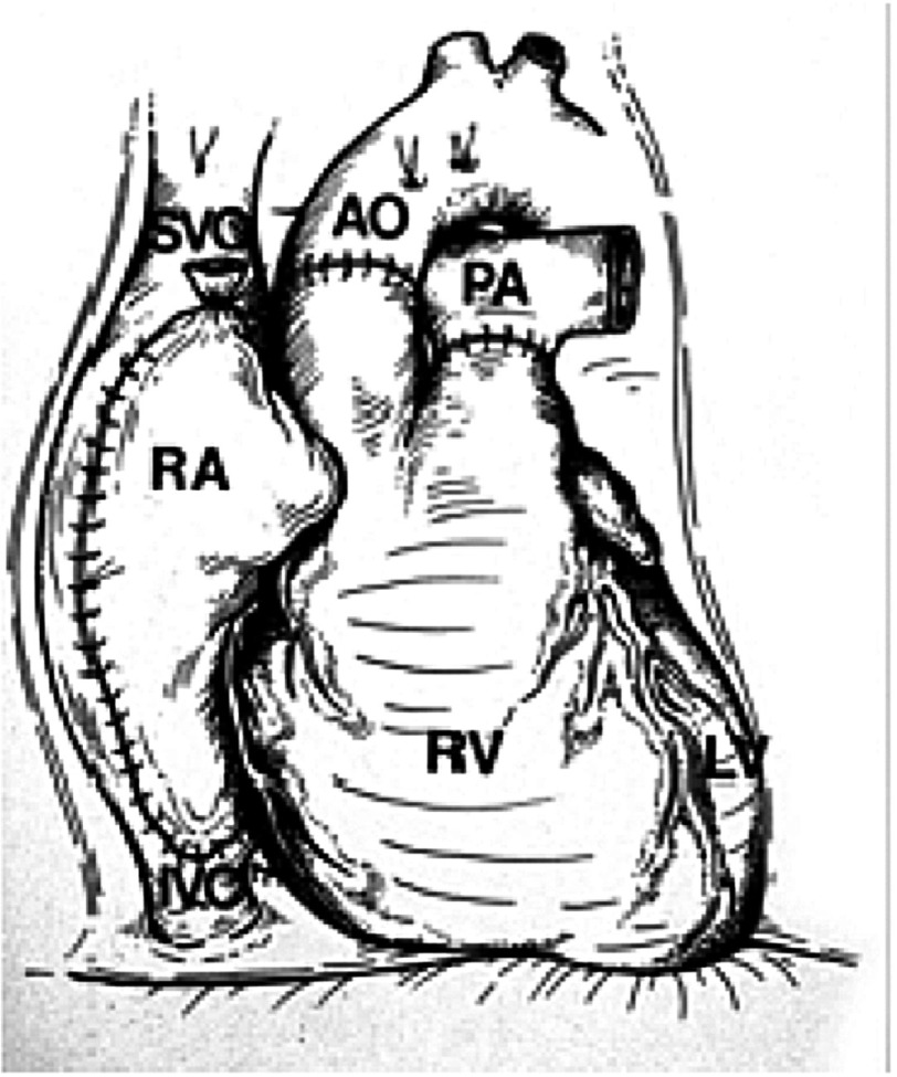 Figure 12.