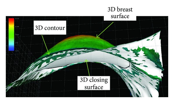 Figure 4