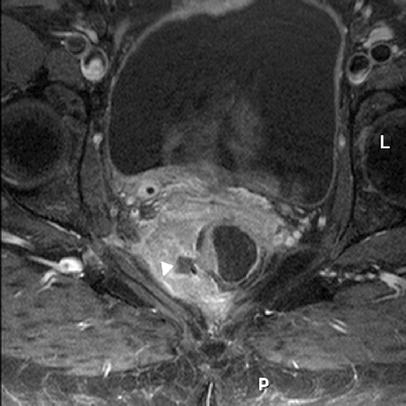 Fig. 8