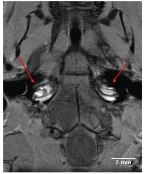 Fig. (1).