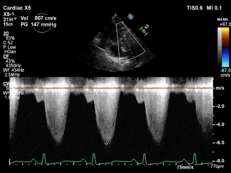 Figure 2